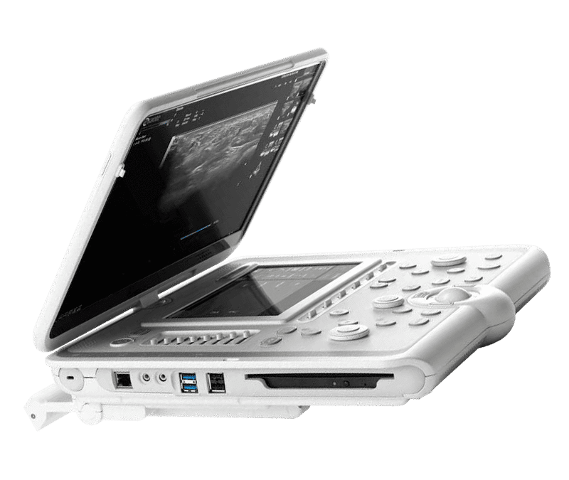 Esaote MyLab Omega