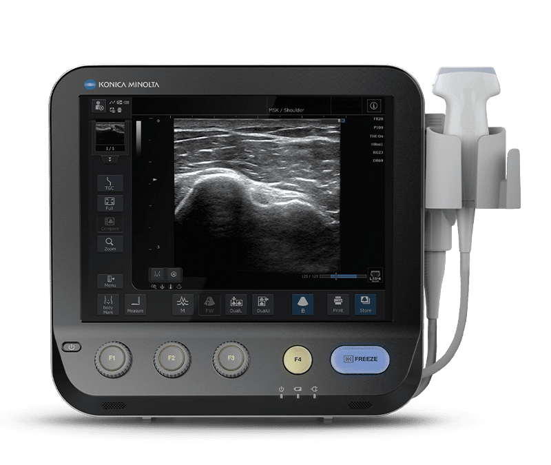 Konica MX1 (Portable Ultrasound System)