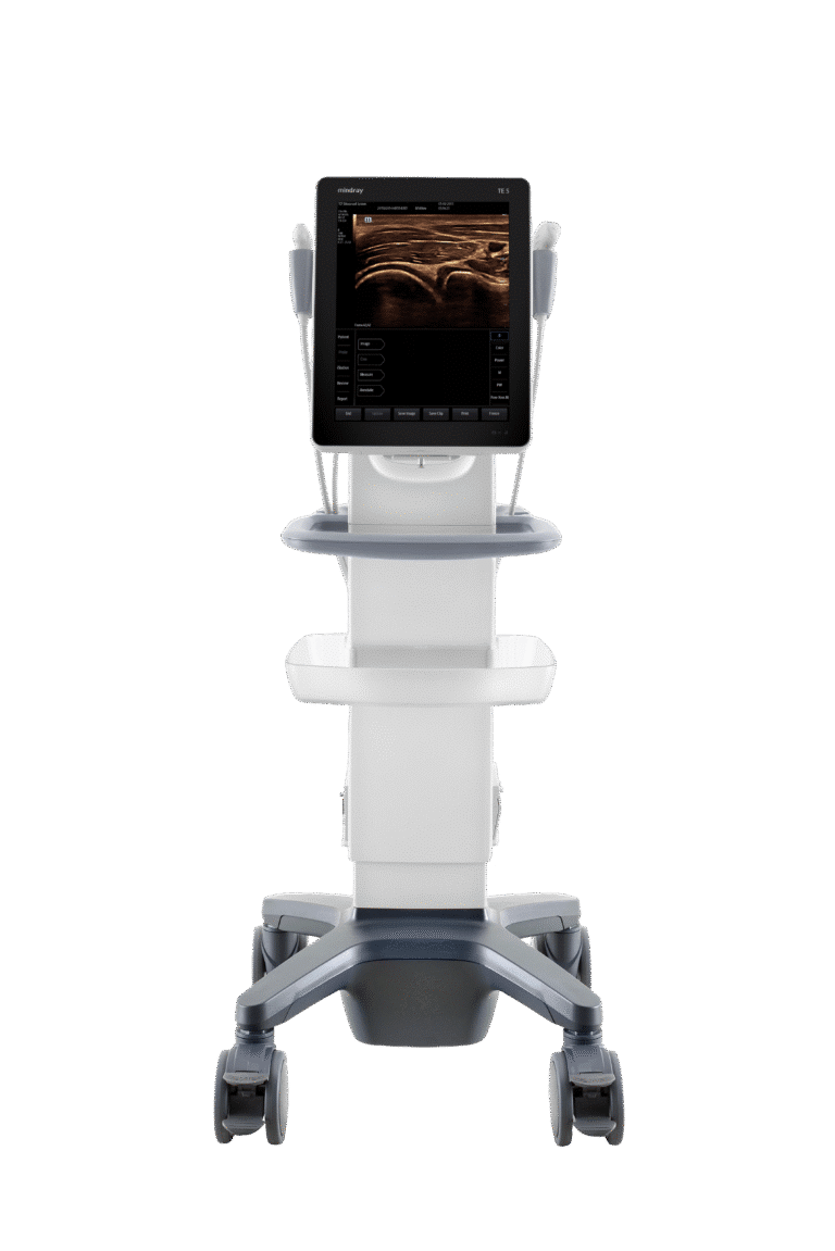 Front view of a Mindray TE5 portable ultrasound system on a mobile cart with a display showing a medical image.