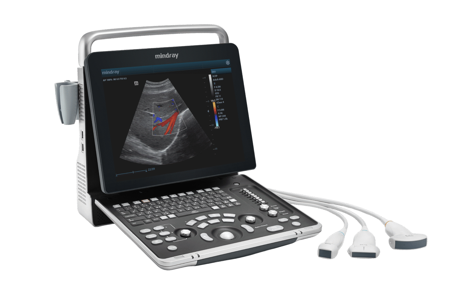 A Mindray Z60 portable ultrasound system with an open lid, displaying a color Doppler image, with three transducers attached.