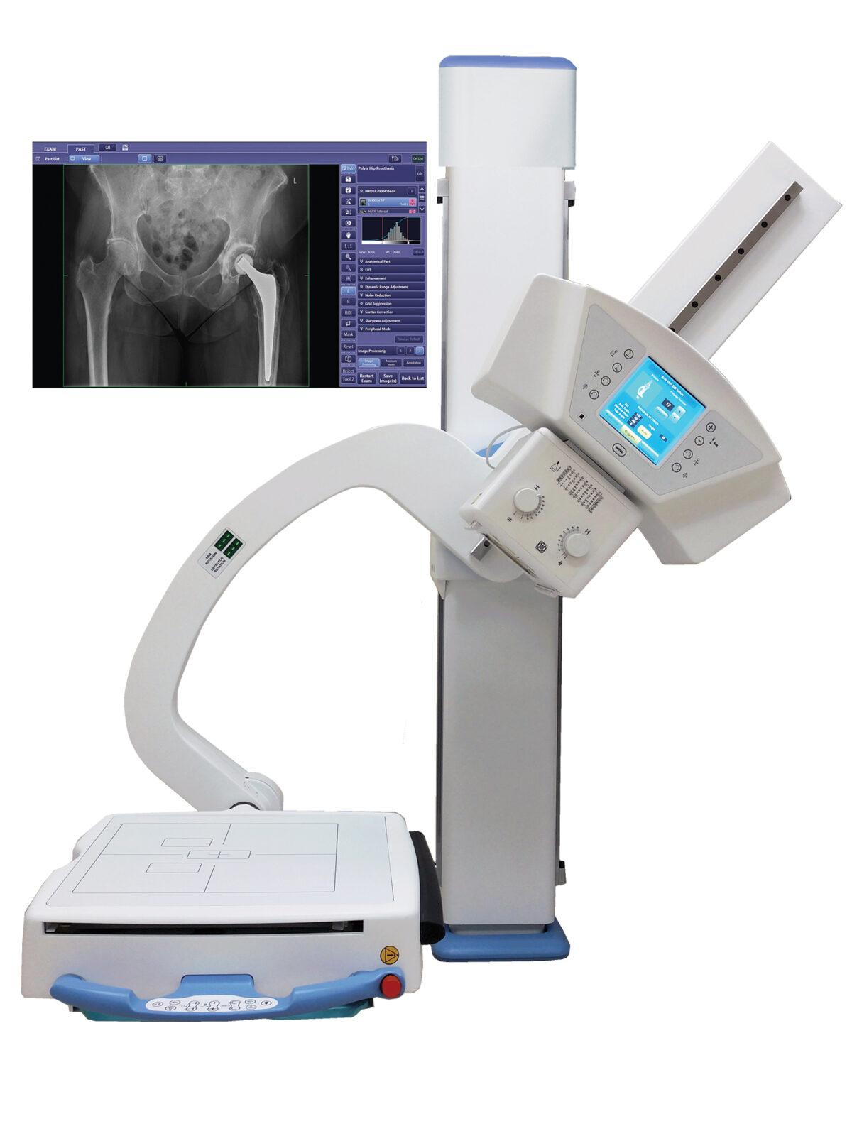 Medical imaging device with patient table and a monitor showing a pelvic x-ray image