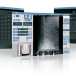 Group of blue-themed medical imaging software windows open on multiple screens, showing x-ray images and diagnostic controls.