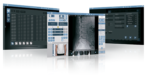 Group of blue-themed medical imaging software windows open on multiple screens, showing x-ray images and diagnostic controls.
