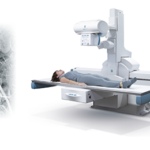Composite image: left panel shows a vascular angiography of blood vessels; right panel shows a patient lying on a linear accelerator used for radiotherapy with a nearby control monitor.