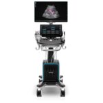 Portable ultrasound machine on a wheeled cart with a high-resolution monitor showing a heart ultrasound image and control panel in front.