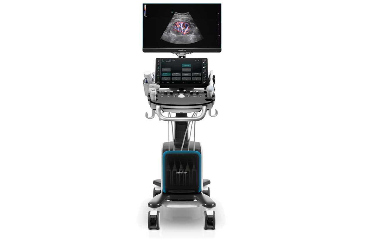 Portable ultrasound machine on a wheeled cart with a high-resolution monitor showing a heart ultrasound image and control panel in front.