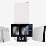 Radiology image workstation with multiple monitors displaying chest x-rays and patient scans; includes a central large screen and side panels for viewing medical images.