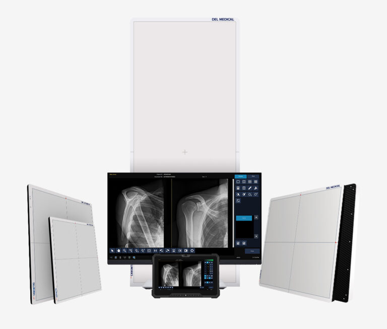 Radiology image workstation with multiple monitors displaying chest x-rays and patient scans; includes a central large screen and side panels for viewing medical images.