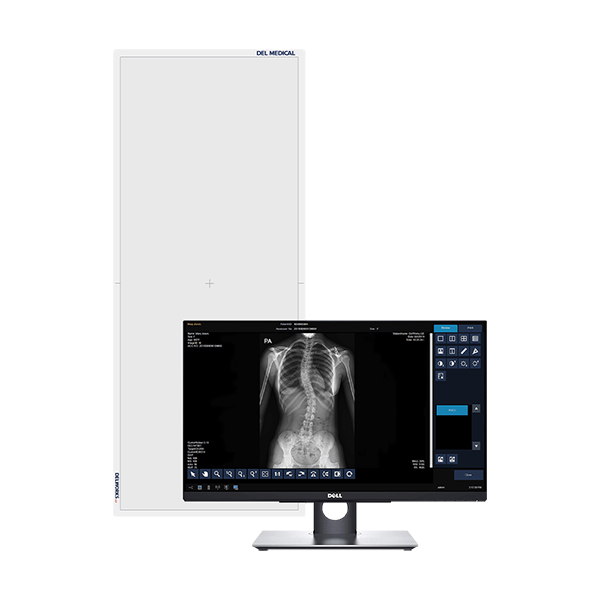 Vertical medical imaging panel beside a dell monitor displaying a pediatric chest and spine x-ray.