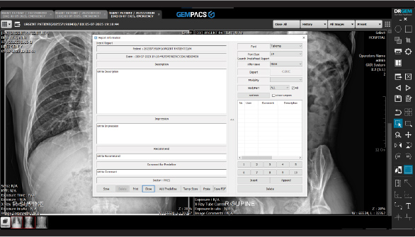 Screenshot of a radiology pacs workstation showing a chest x-ray with a centered patient report entry form and side toolbars.