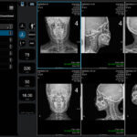 Screenshot of a dental imaging workstation showing a 3x2 grid of head-and-neck x-ray views, with patient data, controls, and a vertical tool panel on the right. The left sidebar includes a procedure/worklist menu, and the top shows device/status readouts.