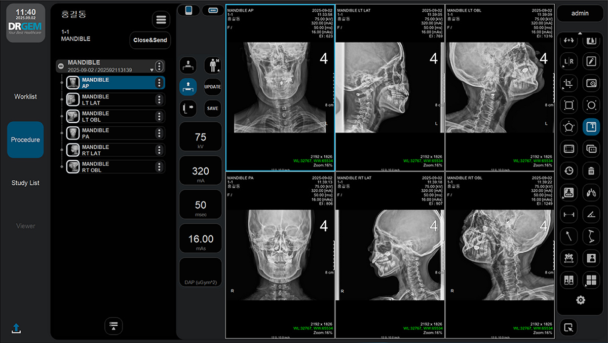 Screenshot of a dental imaging workstation showing a 3x2 grid of head-and-neck x-ray views, with patient data, controls, and a vertical tool panel on the right. The left sidebar includes a procedure/worklist menu, and the top shows device/status readouts.