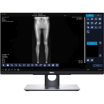 Medical image on a dell monitor showing a leg x-ray within imaging software; right-side tool panel and icons visible.