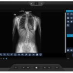 Medical monitor displaying a frontal chest x-ray (pa view) with ribs and spine visible, and a blue control panel on the right side of the screen.