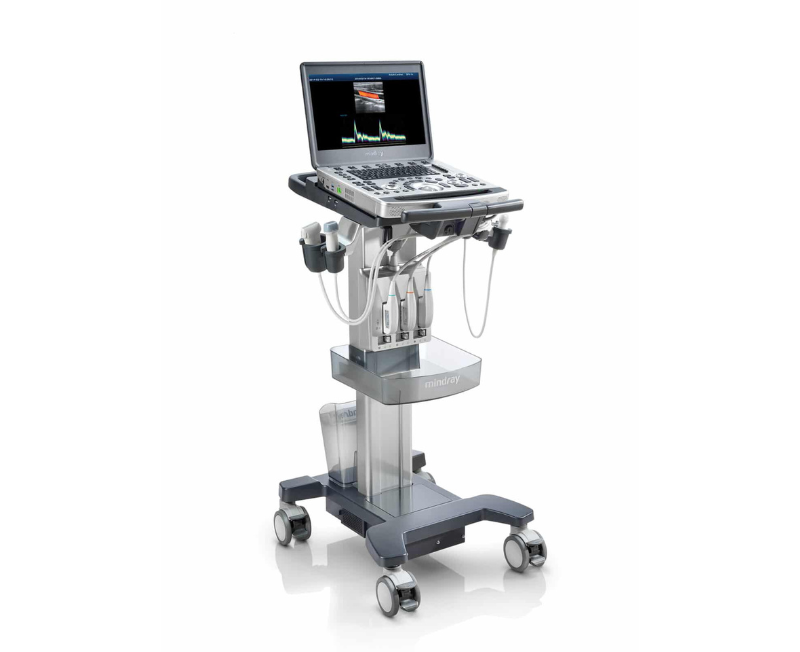 Portable ultrasound machine on a wheeled cart with multiple transducer probes and a monitor displaying an ultrasound image.