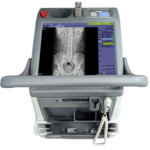 Portable radiography machine with a vertical screen showing a spinal x-ray image