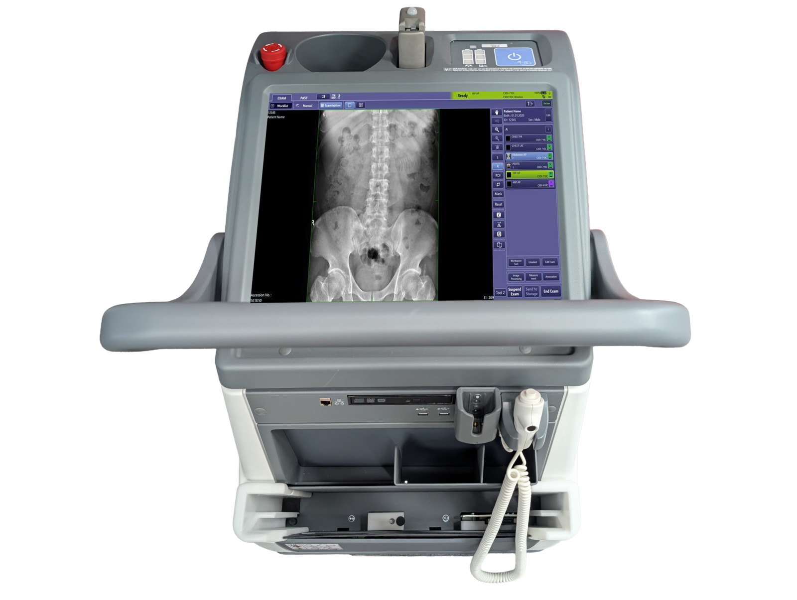 Portable radiography machine with a vertical screen showing a spinal x-ray image