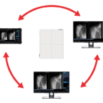 Circular radiology workflow: capture on a handheld device, transfer to a workstation, review on two monitors, then back to the handheld device.