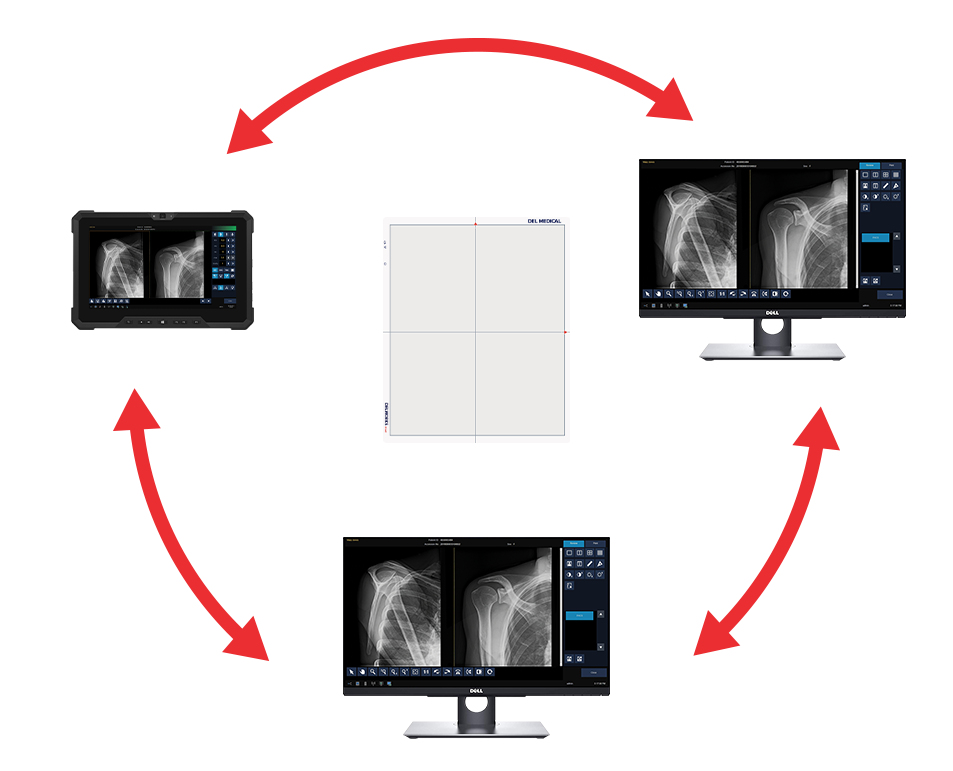 Circular radiology workflow: capture on a handheld device, transfer to a workstation, review on two monitors, then back to the handheld device.