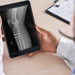 Doctor reviews a tablet showing a lower-leg x-ray with two surgical screws in the ankle region.