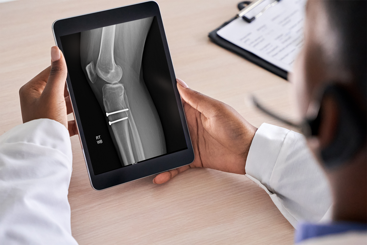 Doctor reviews a tablet showing a lower-leg x-ray with two surgical screws in the ankle region.