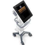 Portable ultrasound machine on a wheeled cart with a monitor and probe holder, angled as if ready for use