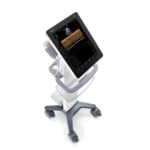 Portable ultrasound machine on a wheeled cart with a tilted touchscreen monitor displaying an ultrasound image.