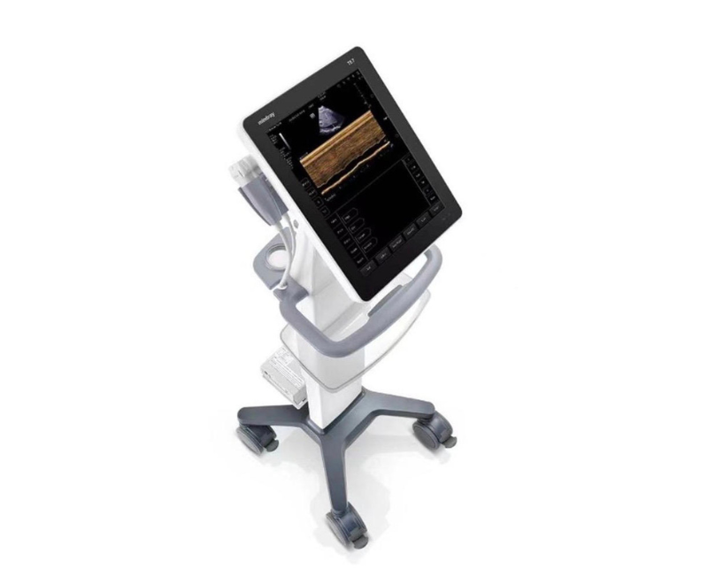 Portable ultrasound machine on a wheeled cart with a tilted touchscreen monitor displaying an ultrasound image.
