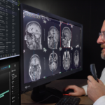 Radiologist examining multiple brain mri scans on a large monitor, holding a handheld device.