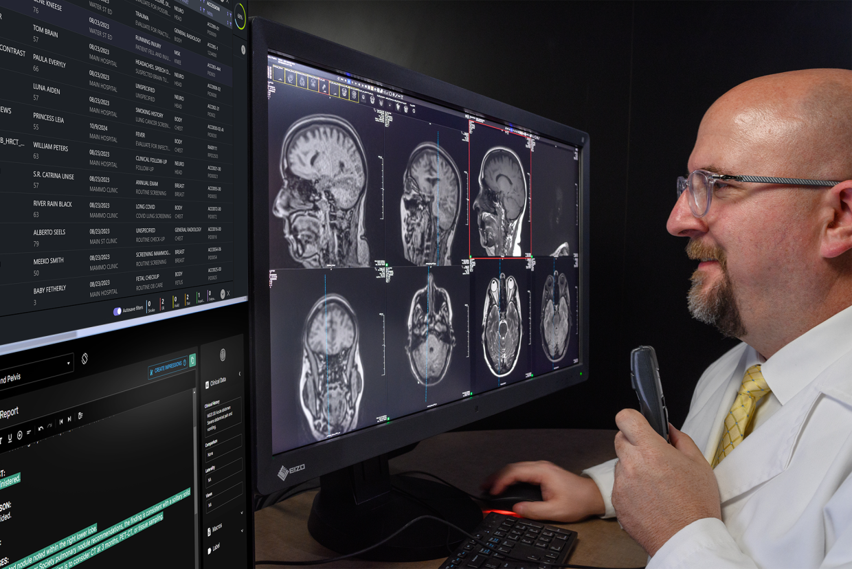 Radiologist examining multiple brain mri scans on a large monitor, holding a handheld device.