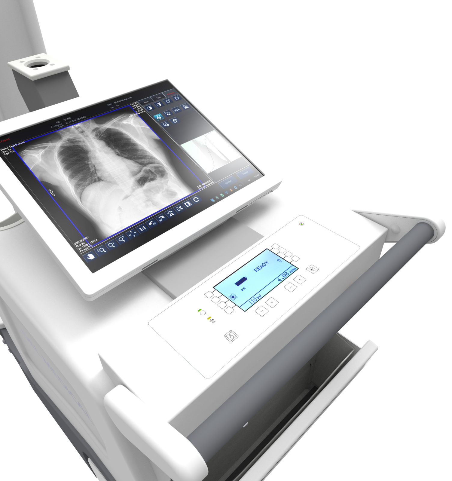 Medical imaging device displaying a chest x-ray on a touchscreen monitor embedded in the machine