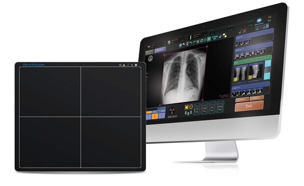 Desktop monitor displays a chest x-ray in medical imaging software; a drawing tablet sits to the left on the desk.