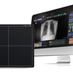 Medical imaging workstation: curved monitor shows a chest x-ray with an control-panel ui, next to a four-quadrant tablet surface on the left.