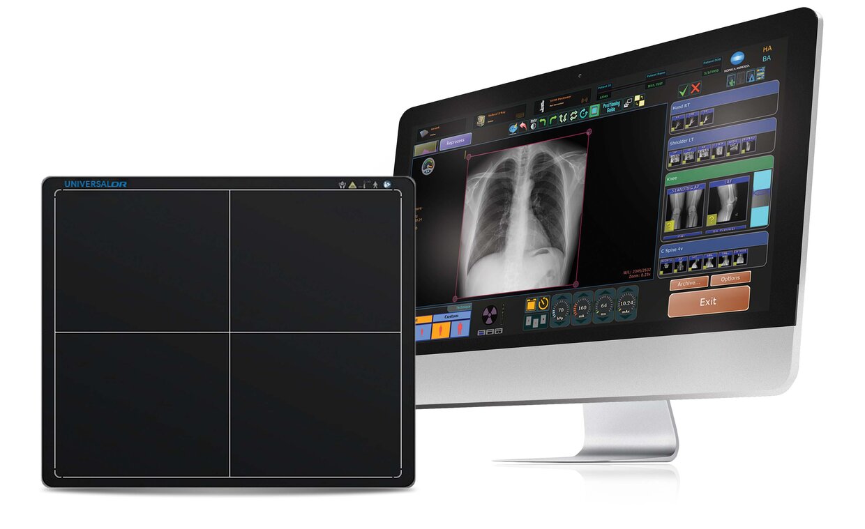 Medical imaging workstation: curved monitor shows a chest x-ray with an control-panel ui, next to a four-quadrant tablet surface on the left.