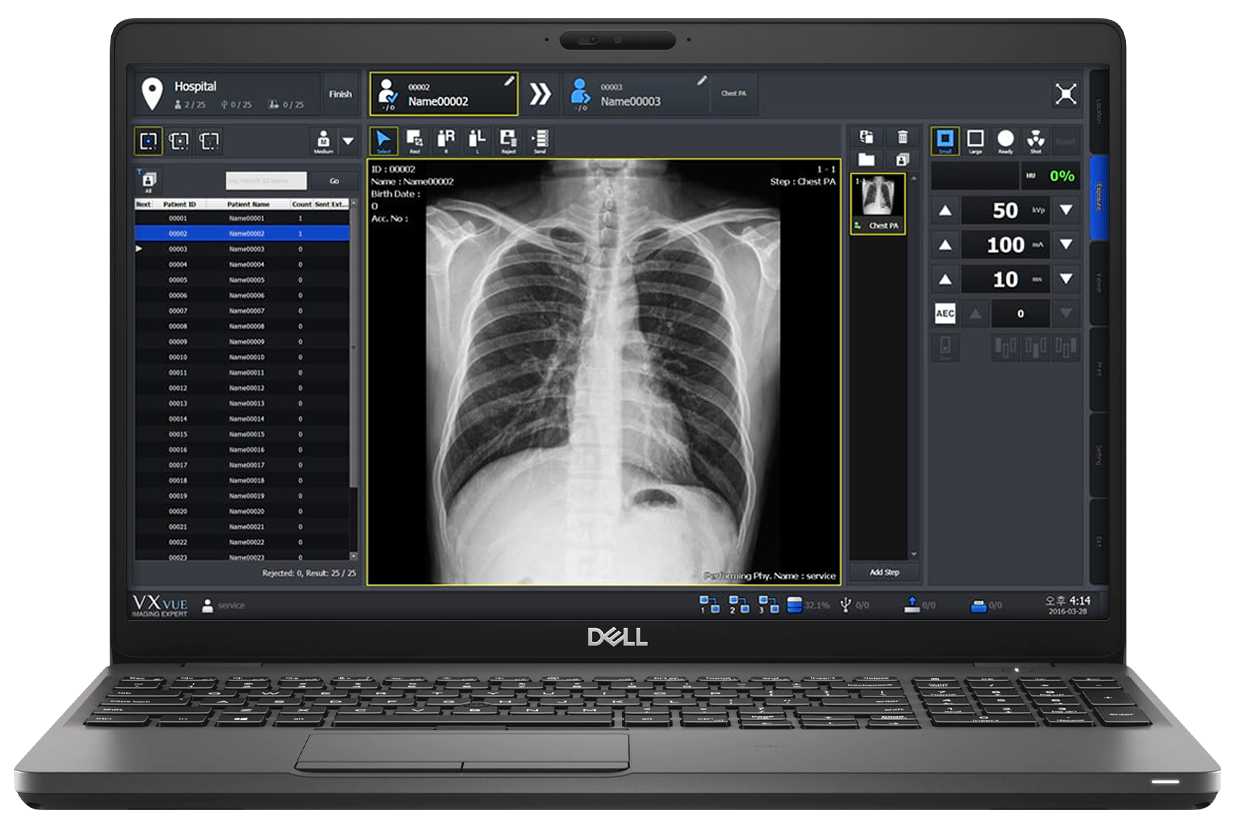 Dell laptop screen displaying a chest x-ray within medical imaging software interface on a radiology workstation