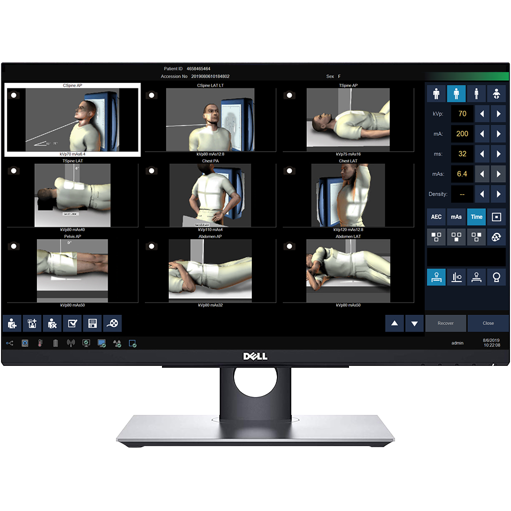 Dell monitor displaying a medical imaging workstation with multiple patient position thumbnails and control panel on the right,”],