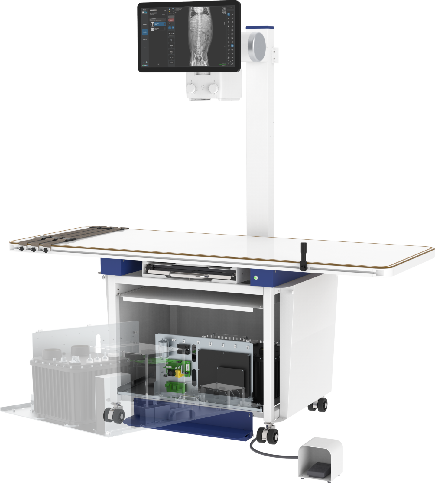 Medical x-ray imaging stand with movable arm and monitoring screen displaying a spine radiograph.