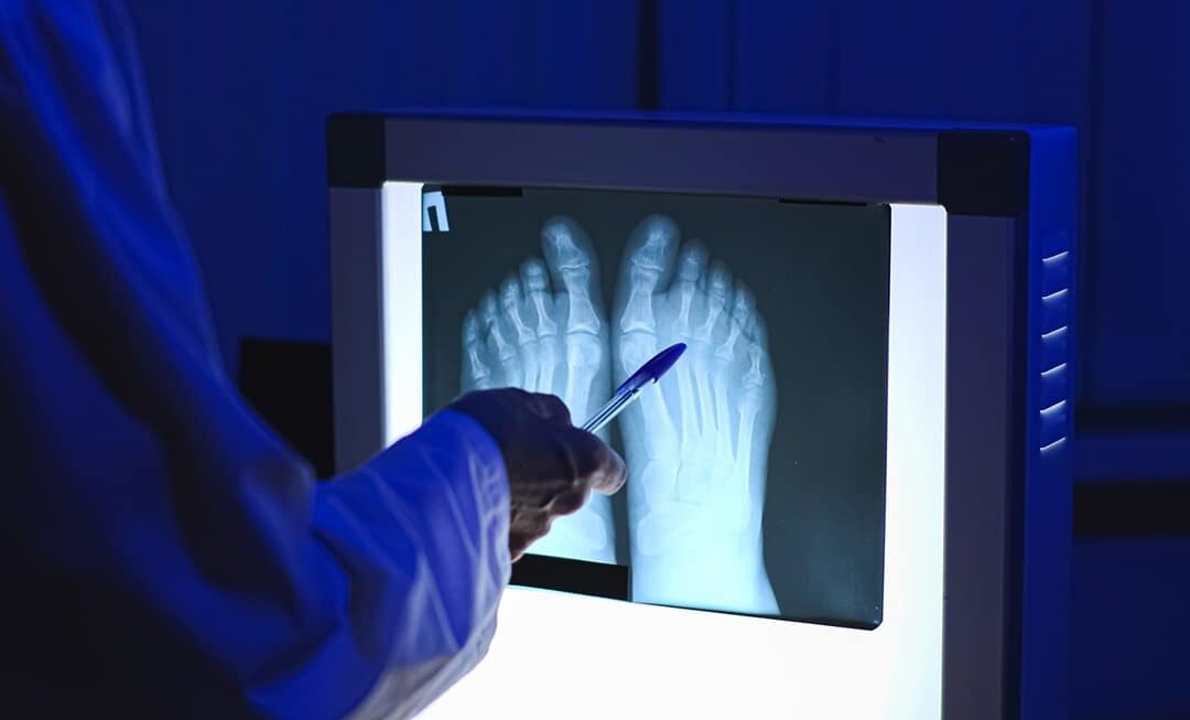 A Podiatrist’s Guide: What to Look for in Your Imaging Equipment