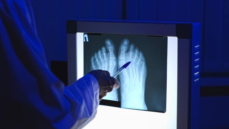 Doctor looks at an xray image of two feet