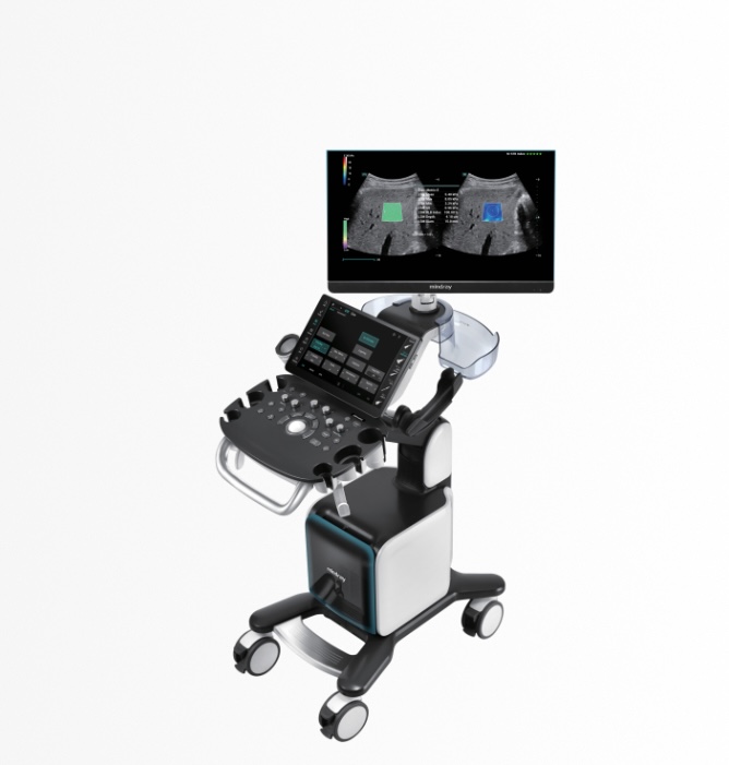 Portable ultrasound machine on a wheeled cart with a monitor, control panel, and transducer probes.
