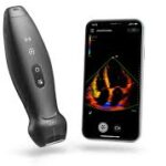 Portable ultrasound probe beside a smartphone displaying a real-time color doppler ultrasound image.