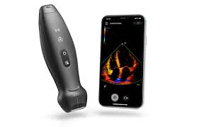 Portable ultrasound probe beside a smartphone displaying a real-time color doppler ultrasound image.