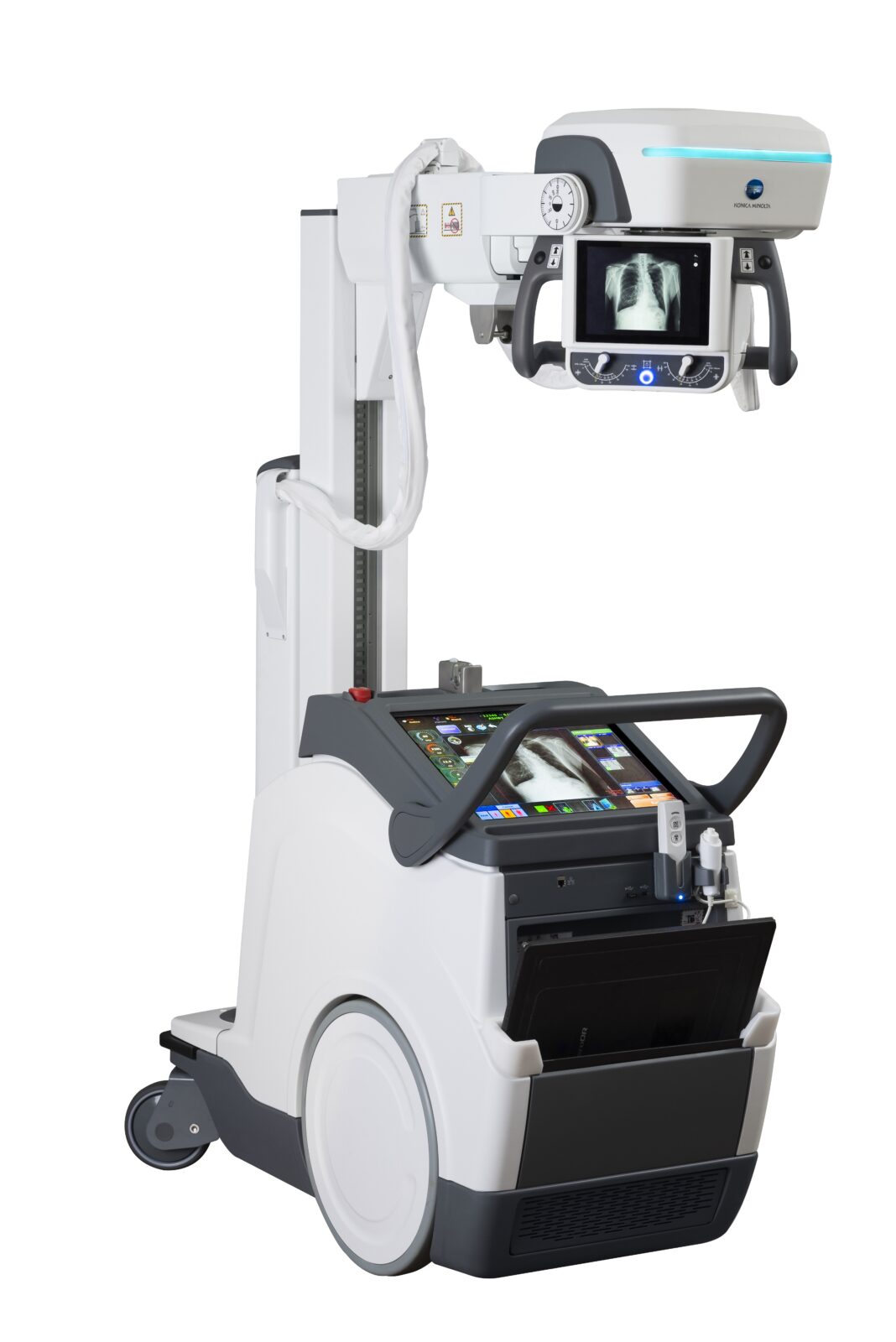 Portable x-ray machine on a wheeled stand with a monitor showing a chest x-ray and a touchscreen control panel below