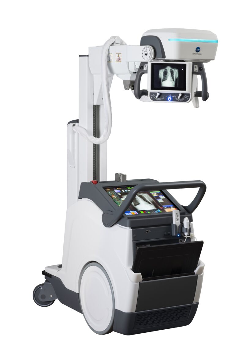 Portable x-ray machine on a wheeled stand with a monitor showing a chest x-ray and a touchscreen control panel below