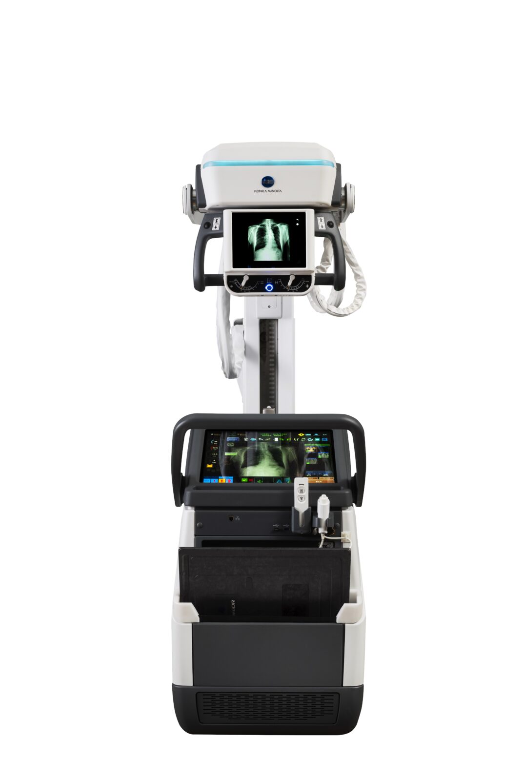 Medical x-ray machine with a chest x-ray displayed on the monitor and a control panel at the front.