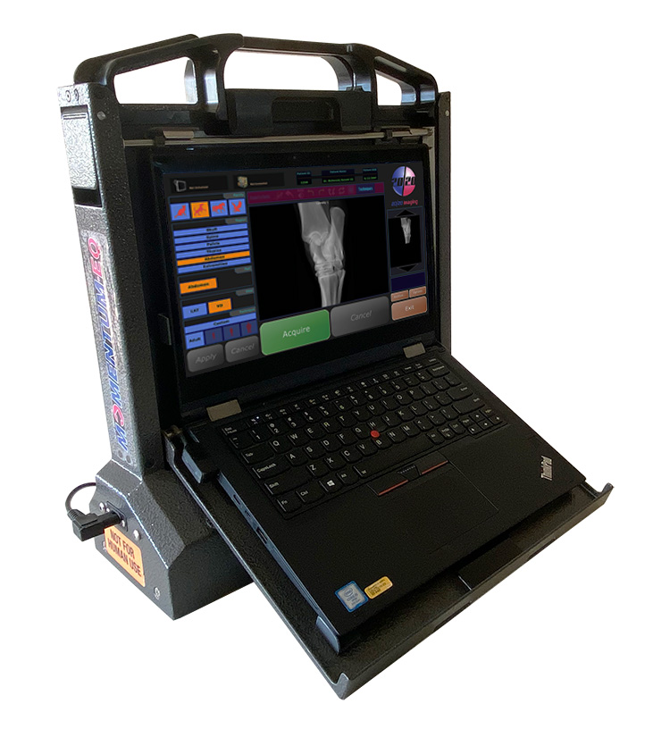 Rugged portable medical imaging laptop with an x-ray image on screen, housed in a protective case with a handle above the screen.