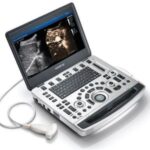 Portable ultrasound machine with a screen displaying two ultrasound images and a connected probe laid beside it.