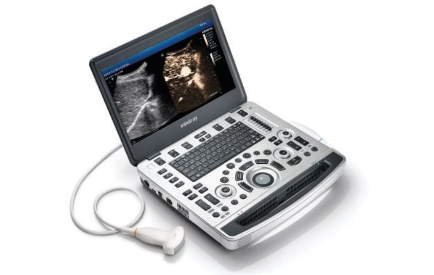 Portable ultrasound machine with a screen displaying two ultrasound images and a connected probe laid beside it.