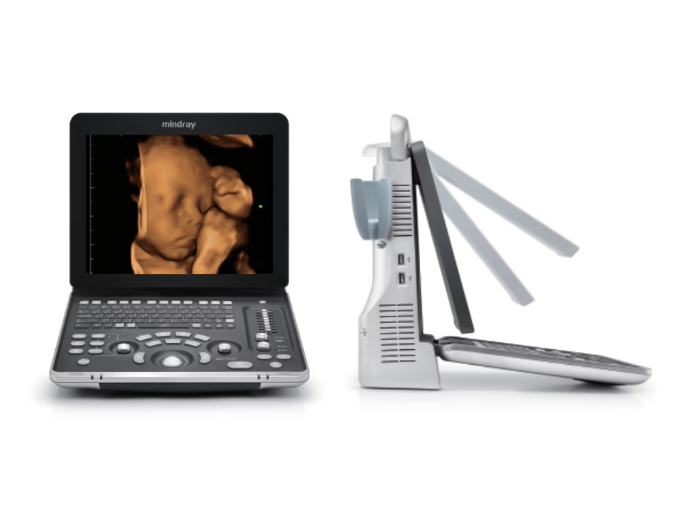 Mindray portable ultrasound with monitor displaying a 3d fetus image beside the handheld probe side view