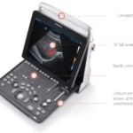Portable ultrasound machine with a 15" tilt lcd, backlit control panel, and 1. 5-hour battery for untethered use.